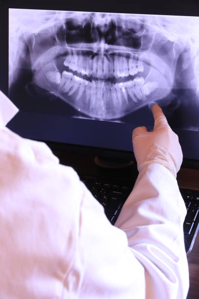 Best Emergency Tooth Extraction in Soddy Daisy, TN